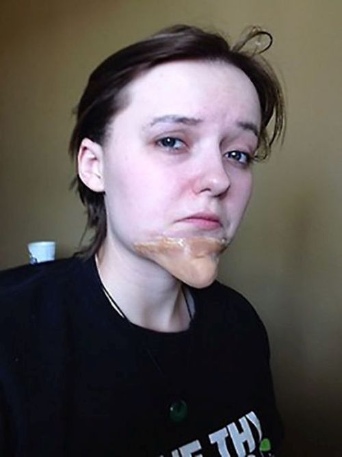    (10 )