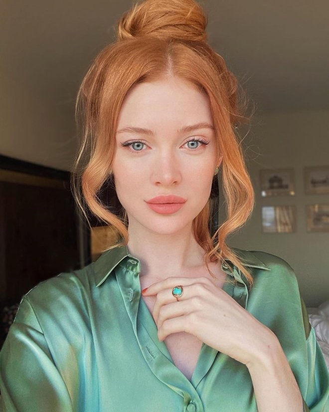      (37 )
